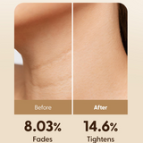 Kem dưỡng da cổ chuyên sâu, cải thiện nếp nhăn, làm sáng vùng da DR.PEPTI Peptide Volume Neck Cream