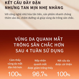 Sample Kem Dưỡng Mắt Nhân Sâm Cô Đặc Dưỡng Vùng Da Mắt Căng Sáng Rạng Rỡ Sulwhasoo Concentrated Ginseng Rejuvenating Eye Cream (12 gói )