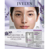 Kemn Meso Tan Nám Phục Hồi JVELYN Stop Aging Azulene PDRN 333 Ampoule Cream