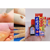 Thuốc đặc trị mụn cóc, các vết chai cứng Ibokorori Nhật Bản