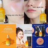 Serum Tinh chất nghệ trị mụn, giảm sẹo dưỡng sáng, tái tạo chống nhăn  da Bidameun age control serum Jee Ara