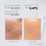 Tinh chất thu nhỏ lỗ chân lông AHA giúp làn da mịn màng CNP Derma Answer Anti-Pore Peel AHA Ampule