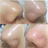 Tinh chất thu nhỏ lỗ chân lông AHA giúp làn da mịn màng CNP Derma Answer Anti-Pore Peel AHA Ampule