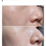 Bộ sản phẩm En Dehors CO2 Poreless Solution Kit hỗ trợ tái tạo da se khít lỗ chân lông