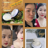 Kem dưỡng trị nám đông y thảo dược  Nadomi Hàn Quốc