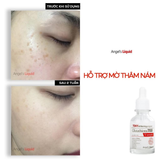 Huyết thanh dưỡng trắng mờ thâm nám Angel's Liquid 7DAY Whitening Program Glutathione 700 V-Ampoule
