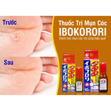 Thuốc đặc trị mụn cóc, các vết chai cứng Ibokorori Nhật Bản