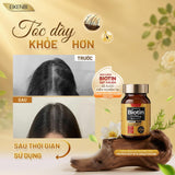 Viên Uống Mọc Tóc & Đen Tóc Premium Biotin 15,000µg Eikenbi