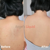 Xịt dưởng trắng body , tẩy da chết , thoáng lổ chân lông  Cải Thiện Mụn Lưng, Mờ Thâm Sau Mụn Angel's Liquid phiên bản nâng cấp