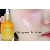Serum Tinh chất nghệ trị mụn, giảm sẹo dưỡng sáng, tái tạo chống nhăn  da Bidameun age control serum Jee Ara