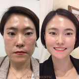Sample Tinh chất Peel tái tạo da chuyên sâu, loại bỏ da hư tổn, cải thiện làn da CNP Rx Skin Rejuvenating Intensive Peel (2ml/ống x30 ống =60ml)