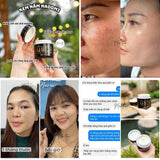 Kem dưỡng trị nám đông y thảo dược  Nadomi Hàn Quốc