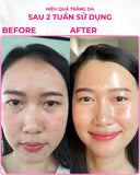Nước uống kích trắng NMN Perfect White Ever 18 Eikenbi (10 lọ).