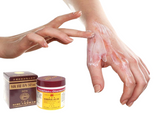 Kem Bôi Lành Vết Thương Oronine H Ointment
