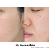 Tinh Chất Tái Sinh Trắng Da Illuminating Regenerating Essence - Tinh chất trắng da Whoo hoa hiên mini 8ML