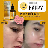 Tinh chất chống lão hóa Pure Retinol High Class Moist Essence .