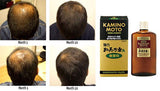 Serum dưỡng kích thích mọc tóc Kaminomoto Higher Strength Nhật Bản.