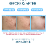 Kem Nám Tàn Nhang Vi Gai TEMP:31 - Mờ Nám, Dưỡng Trắng, Làn Da Rạng Rỡ Ultimate Formulation Cream