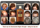 Serum dưỡng kích thích mọc tóc Kaminomoto Higher Strength Nhật Bản.