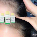 Tinh chất kích thích mọc tóc thảo dược Chosei 5% Nhật Bản - 30ml lọ