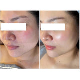 Serum Tế Bào Gốc tái tạo da dưởng trắng  với NAD,NMN, GOLD, PEARL,EGF  Stem Cell R5  Tom Tit Tot