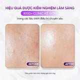 Kem Dưỡng Ẩm & Phục Hồi Da Chuyên Sâu, Cải Thiện Mụn & Kích Ứng VQM Phytocin V2